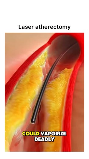 Animations | Follow @surgicalanimation for more! 🏥 | Instagram