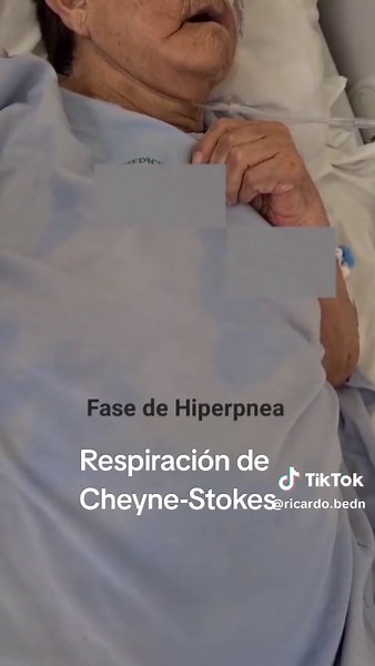 Respiración de Cheyne-Stokes en Medicina Interna