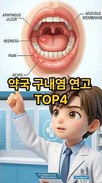 약국 구내염 연고 TOP4 완벽 정리 (알보칠, 오라메디, 페리덱스, 페리톡겔)