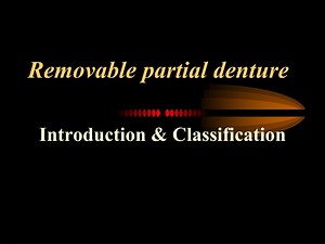 Understanding Removable Partial Dentures: Classification and Treatment Options - SlideServe