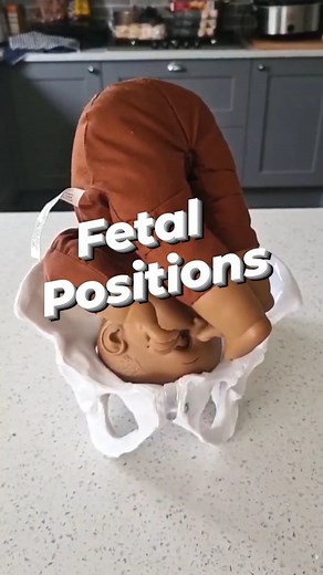 22K views · 75 reactions | Some of the fetal positions and...