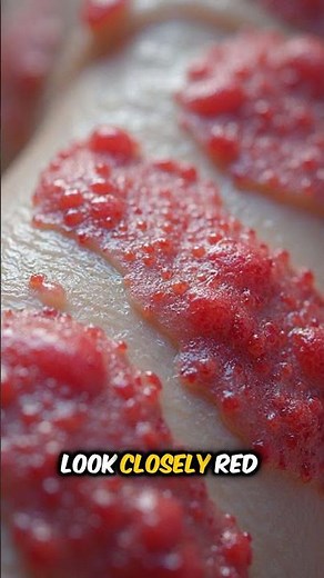 Understanding Psoriasis #skinhealth #dermatologyeducation #psoriasisawareness #chroniccondition
