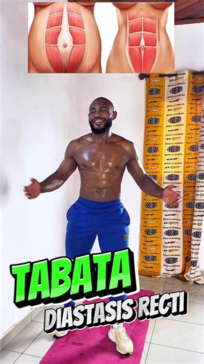 04 minutes « TABATA DIASTASIS RESTI🍫🔥✅🏠 » - tu fais 05 tours - tu prends 2min 30 sec de repos après chaque tour Tu as un problème de Diastasie alors voici une séance à faire à la la maison pour réduire ton Diastasie et renforcer tes muscles Bon entraînement !👍🔥✅ #creatorsearchinsights #abworkout #homefitness #corestrength #fitnesstips @Slimsolutionbybrons @faniiiiii27💚🤍❤️@Kebemaje @❤❤❤ @MyNutriGlow @