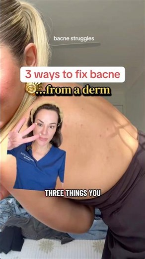 3 Ways To Fix Bacne — From A Derm | #shorts #skincare |