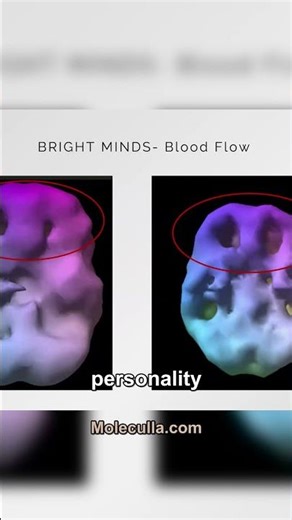 What Happens When Your Prefrontal Cortex Struggles? #brainhealth