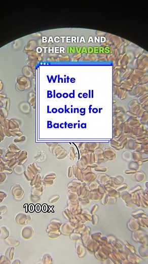 White Blood Cells Searching for Bacteria Under Microscope