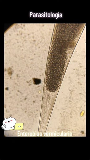 Enterobius vermicularis: Todo sobre este parásito