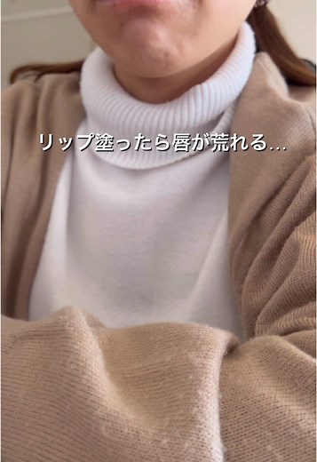 唇が荒れる原因とは？リップ成分をチェックしよう