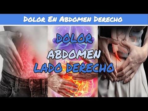 ⚕️🩺 DOLOR EN LADO DERECHO DEL ABDOMEN - Apendicitis Aguda