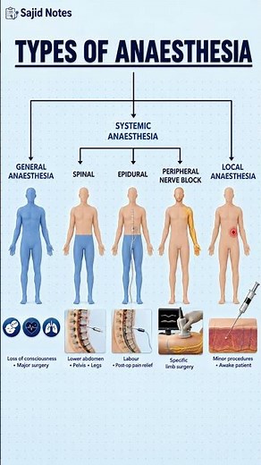 Types of Anaesthesia Explained Generalvs Regional vs Local Anaesthesi#Anaesthesia #MedicalEducation