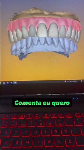 VOCÊ SABE FAZER PRTOCOLO DENTOGENGIVAL? #exocad #fluxodigital #dentalcaddesign