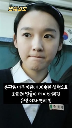 성형의 진실: 더욱 미워진 사례들