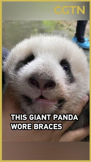 This giant panda wore braces to fix his crooked jaw. It worked.
