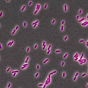 Common Antimicrobial Agent Reduces the Efficacy of Antibiotics | Microbiology