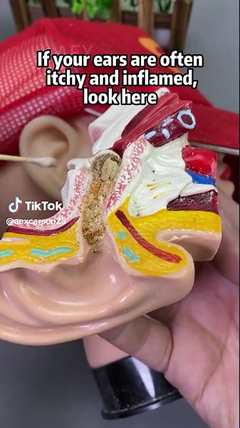 #visualearpicking #earpick #earclean #visualearpick #otoscope #deal