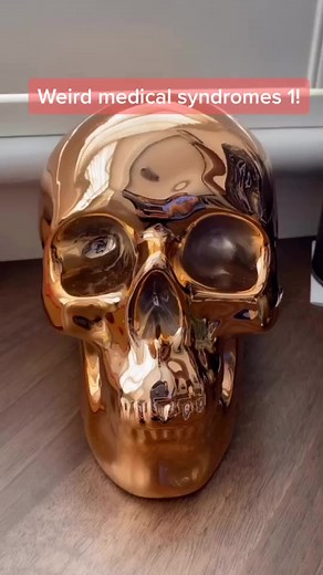 Weird syndromes! What do you think of these?? #weirdfacts #medicalfacts #doctor #medical #nurse #medicalstudent #premed #paramedic #psychiatry