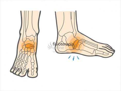Hueso escafoides o navicular