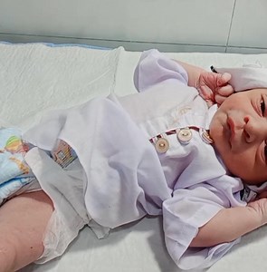 23K views · 600 reactions | In this video, we share the case of a...