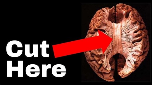 The Unsettling Truth about Human Consciousness | The Split Brain experiment that broke neuroscience – Lifeboat News: The Blog
