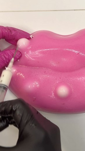 1.4M views · 30K reactions |  #asmrsounds #asmr #viral #fypシ #relax #skincare #mouthsounds #satisfying #tingles #asmrtriggers #acne #asmr_tingles #asmrrelax #asmrroleplay #reels #asmrvideo #lofi #lofiasmr | Mochi Pimple Popper ASMR | Facebook