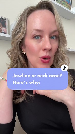 Understanding the Causes of Neck and Jawline Acne