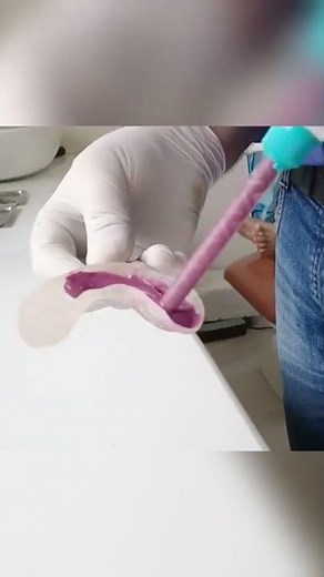 Impression with Addition silicone material