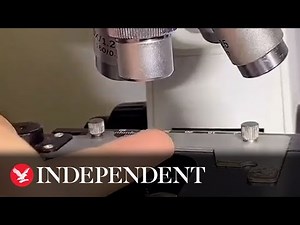 Scientist reveals what human finger looks like under microscope