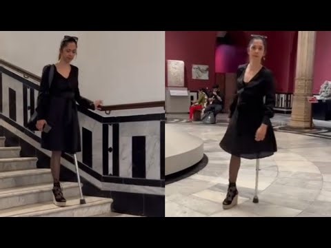 Amputee lady life after amputation: walking navigating the stairs