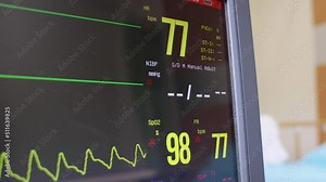 Electrocardiogram, EKG, heart rate monitor in hospital room for checking heart rate hospitalized patients