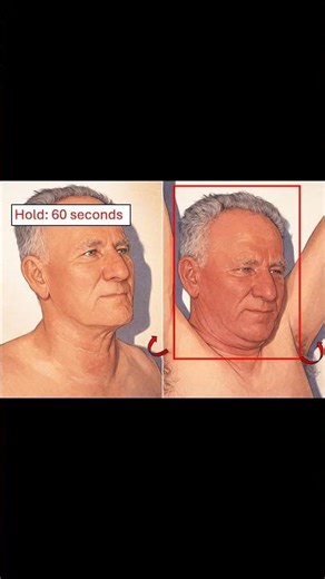 🩺 Pemberton’s Sign Explained – Quick Clinical Exam #physicalexam #anatomy #meded #medicaleducation