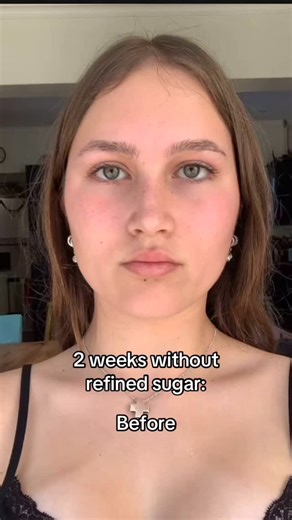 Emily Blunt | Weight loss Coach on Instagram: "I’ve lost over 53kg with one simple method that has transformed my life forever🥲. If you're trying to lose weight or fat and feel like giving up, leave a comment with “Fit” and I'll coach you to drop up to 2kg every week. Before commenting “Fit”, make sure you're following me, else Instagram won't let me DM you 🫡🎁. I tried every diet imaginable, punishing myself with endless intermittent fasting and juicing regimens, but none of them worked for m