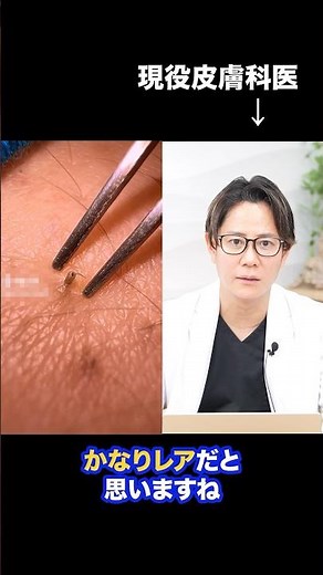 [Blackhead Removal] Remove long blackheads for a refreshing feeling! A dermatologist explains #sh...