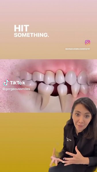 Understanding the Effects of Losing a Tooth