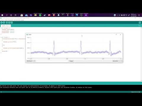 Electrocardiograma portátil, conexión con Arduino y procesamiento avanzado de la señal AD8232