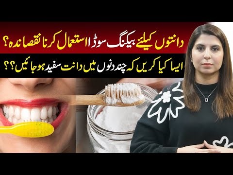 Is Baking Soda Harmful for Teeth? Safe Ways to Whiten Teeth Fast | Dr Anum Raza