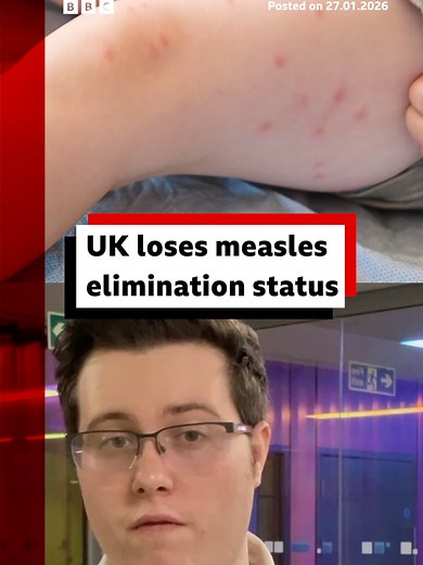 The move was based on the spread of cases in 2024 when there were 3,600 suspected cases. #Measles #WorldHealthOrganization #Health #Vaccination #Jab #BBCNews