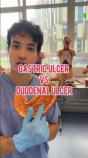 GASTRIC VS DUODENAL ULCERS #medicine #anatomy