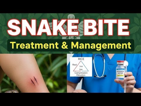 Snake Bite treatment in hospital