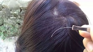 White Hair Plucking: ಬಿಳಿ ಕೂದಲು ಕೀಳುವುದು ಸರಿಯೋ? ತಪ್ಪೋ?
