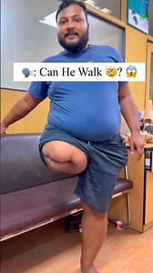 Above Knee Leg Cost | Diabetic Amputation | Ossur Foot | Carbon Foot | #ossur #artificiallimb #3r80