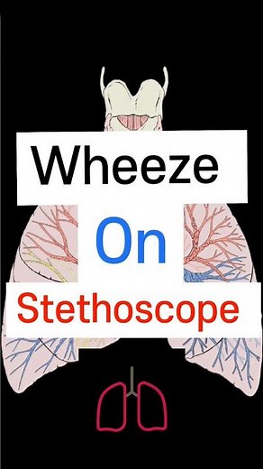 Wheeze on Stethoscope 🩺 Lung sound #neetpg #fmge #medicalstudent