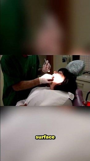 Saving a Split Tooth The Dental Miracle That Prevents an Extraction