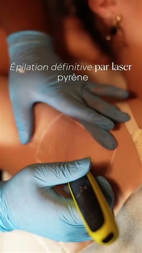 Pyrène, Expert #epilationdefinitive #photo-epilation #electro-epilation #epilationlaser