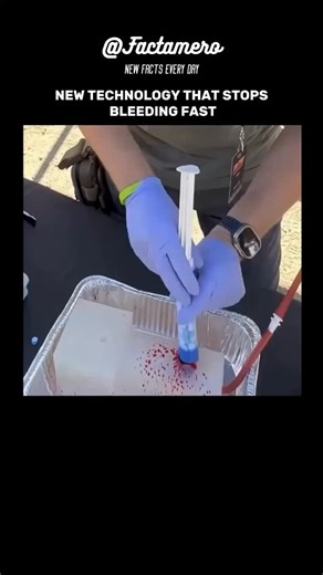 Factamero_ on Instagram: "Instead of bandages or liquids, compressed sponge-like granules are injected directly into the wound. When they touch blood, they rapidly expand, filling the cavity and creating internal pressure. This makes it possible to stop bleeding where tourniquets and manual compression fail — especially in deep or irregular injuries. More fascinating facts here — @factamero Video author unknown. If you are the author, please contact us via DM. Would you trust this technology in 