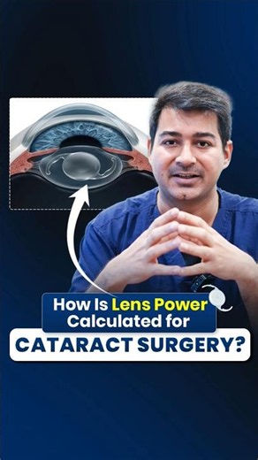 How is Lens Power Calculated for Cataract Surgery?