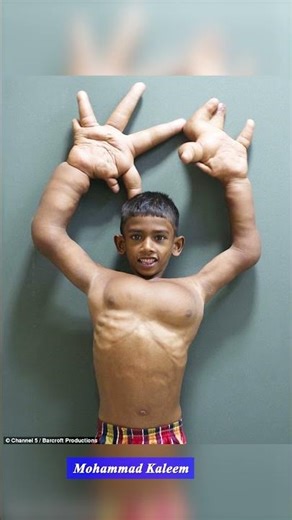 Top The World's Strangest Bodies!