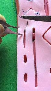 Running subcuticular suture | Dermhacks