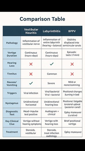 Difference Between Vestibular Neuritis, Labyrinthitis, and BPPV | MRCP UK