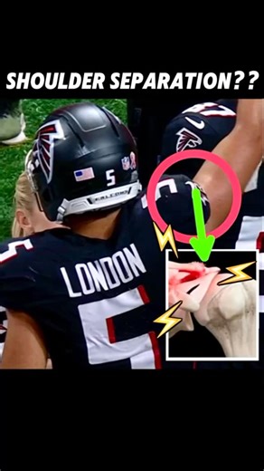 Nav Singh Badesha, M.D. on Instagram: "#Falcons Drake London went down with a shoulder injury today against the #buccaneers & didn’t return, lets break this down #Medspiration . . . #drakelondon #fantasyfootball #fantasyfootballadvice #nflfantasy #dirtybirds #sportsmedicine #sportsscience #espn #sportscenter"