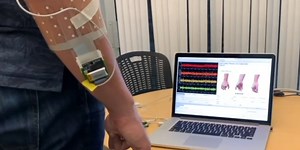 A Gesture Recognizing Armband